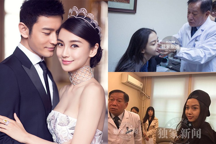 Sinh năm 1989, diễn viên kiêm người mẫu Angelababy vừa kết hôn với nam tài tử nổi tiếng Huỳnh Hiểu Minh. Từ khi bước chân vào showbiz, cô liên tiếp dính tin đồn phẫu thuật thẩm mỹ. Tuy nhiên, mới đây, cô đã được xác nhận nhan sắc chưa qua "dao kéo".